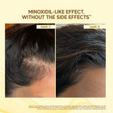 Hair Growth Heroes